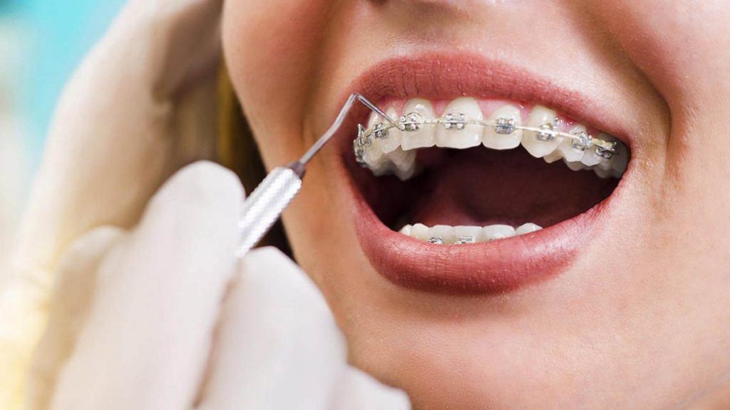 Welcome to Divine Smiles: Your Partner in Oral Health